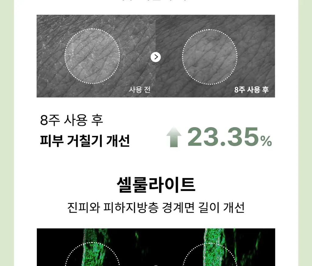 [탄력/목주름 개선] 힐그리즈 레티노이드 0.1% 퍼밍 바디 세럼 150ml 상세페이지 34
